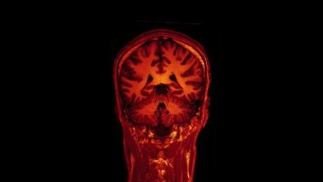 Studies show hands-free devices are still unsafe! How your brain causes car accidents.